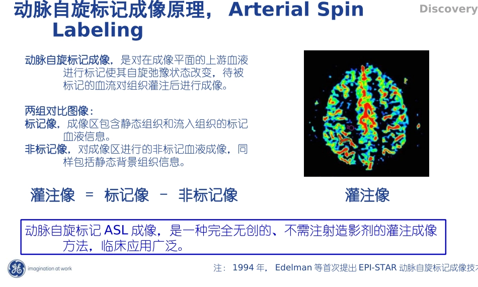 头部ASL灌注成像_第3页