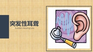 突发性耳聋精编版