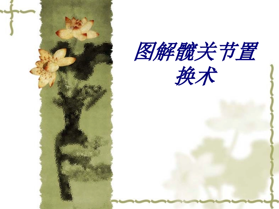 图解髋关节置换术讲义_第1页