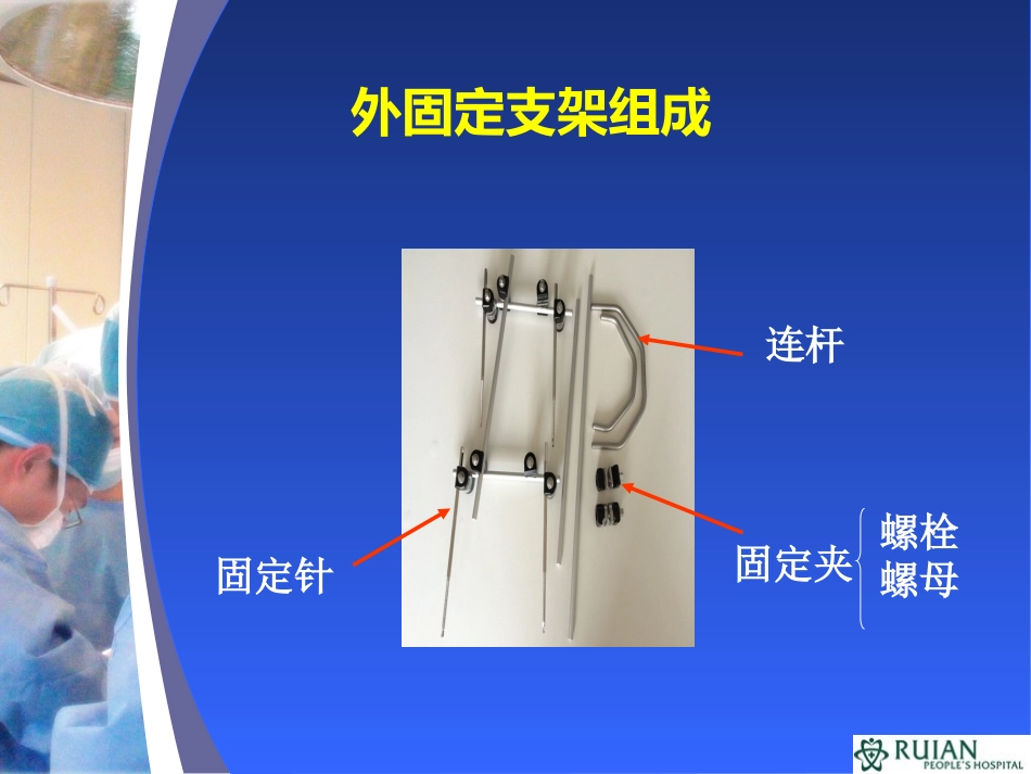 外固定架治疗胫腓骨骨折的临床观察和护理创新教材_第3页