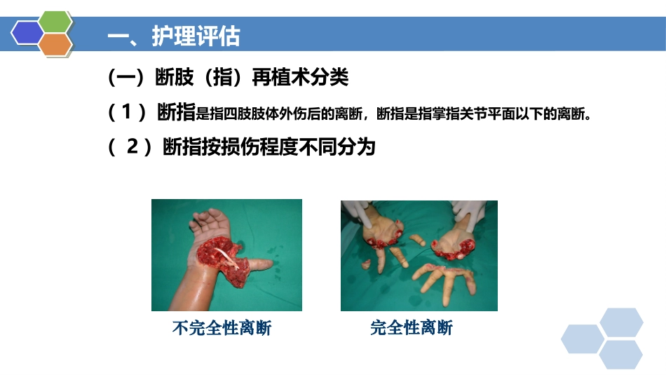 外科护理断肢指再植患者的护理_第3页