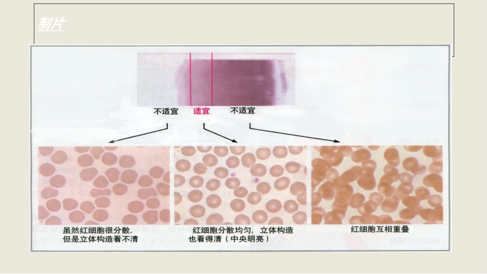 外周血细胞形态_第3页