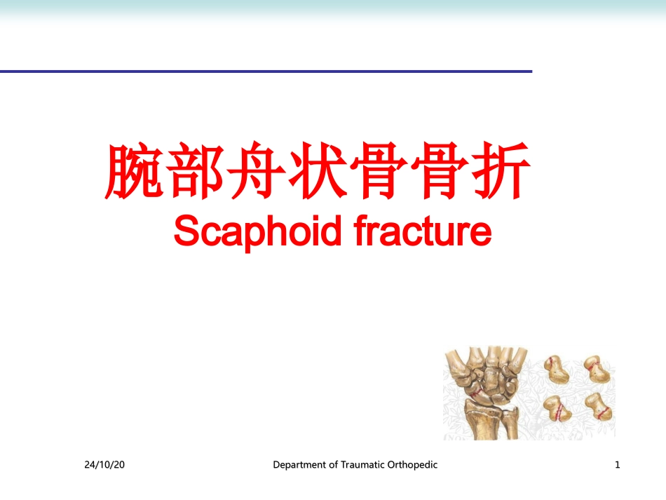 腕部舟状骨骨折剖析_第1页