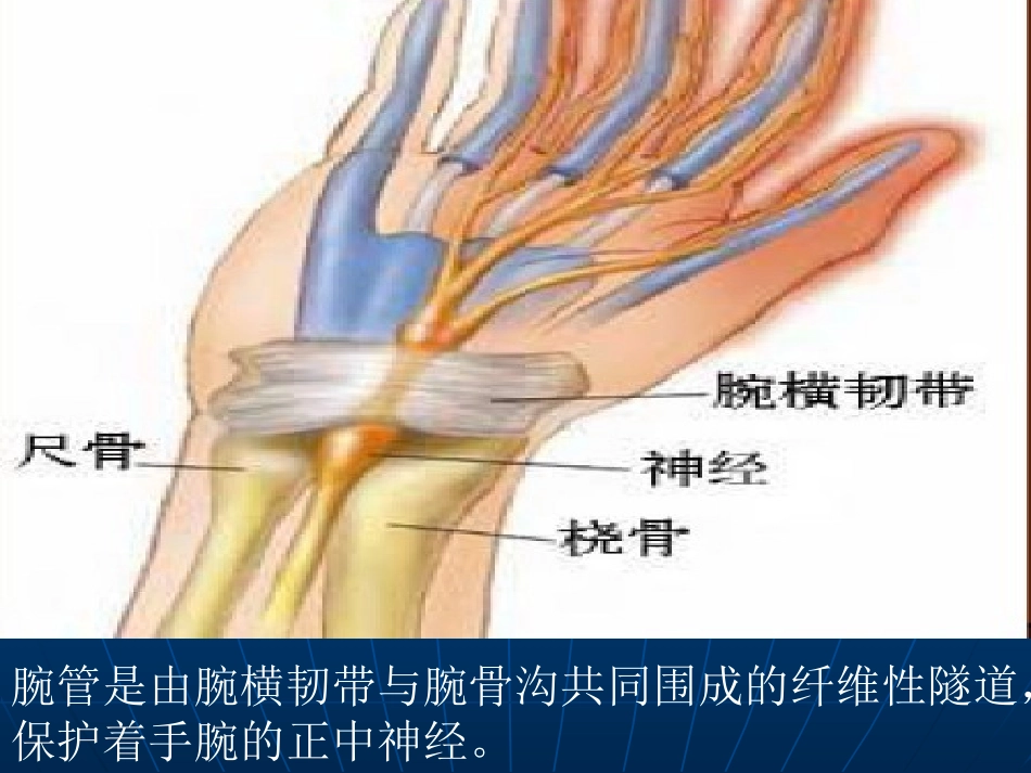 腕管综合征护理_第3页