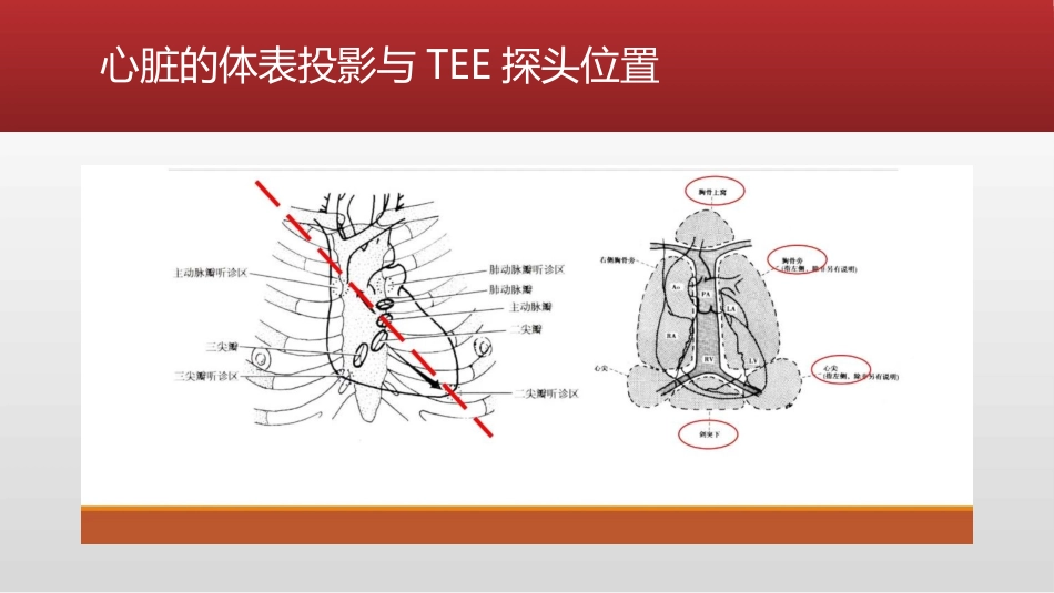 围术期经胸超声心动图TEE_第3页