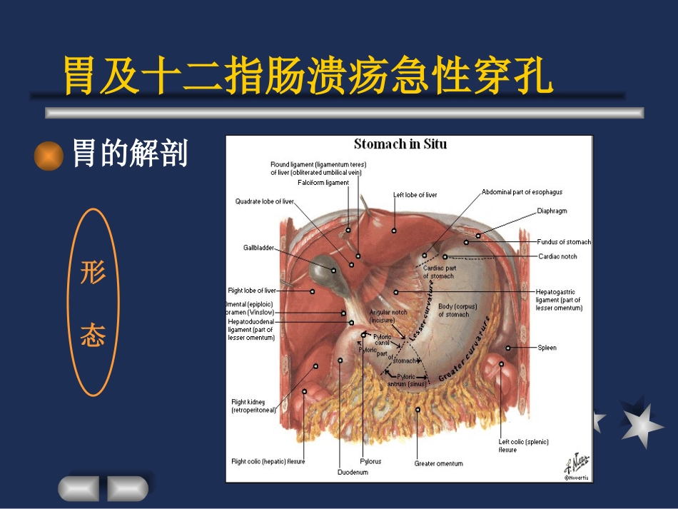 胃及十二指肠溃疡急性穿孔精_第3页