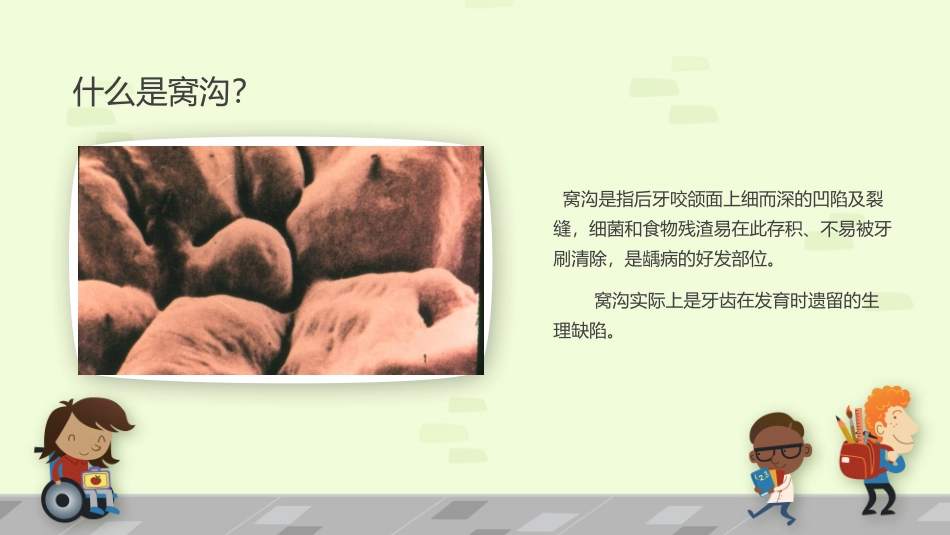 窝沟封闭医学_第3页