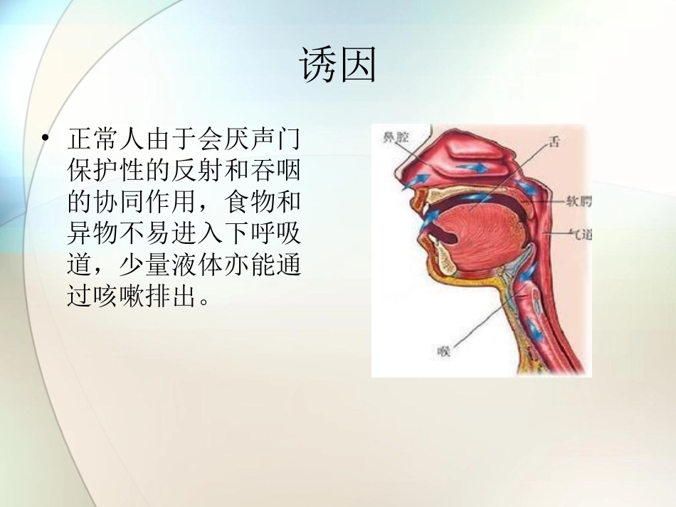 吸入性肺炎参考课件_第3页