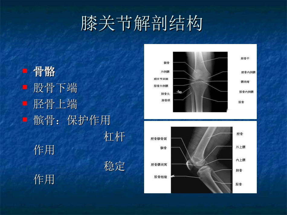 膝关节骨性关节炎健康教育讲座课件_第2页