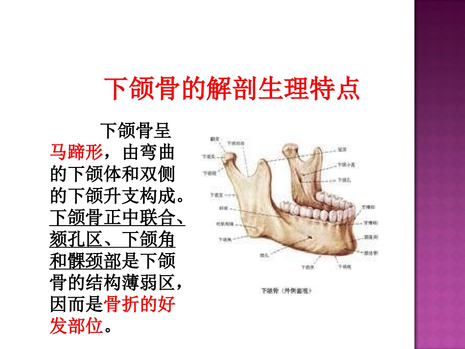 下颌骨骨折的护理查房_第3页