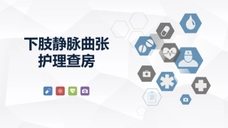 下肢静脉曲张的护理查房