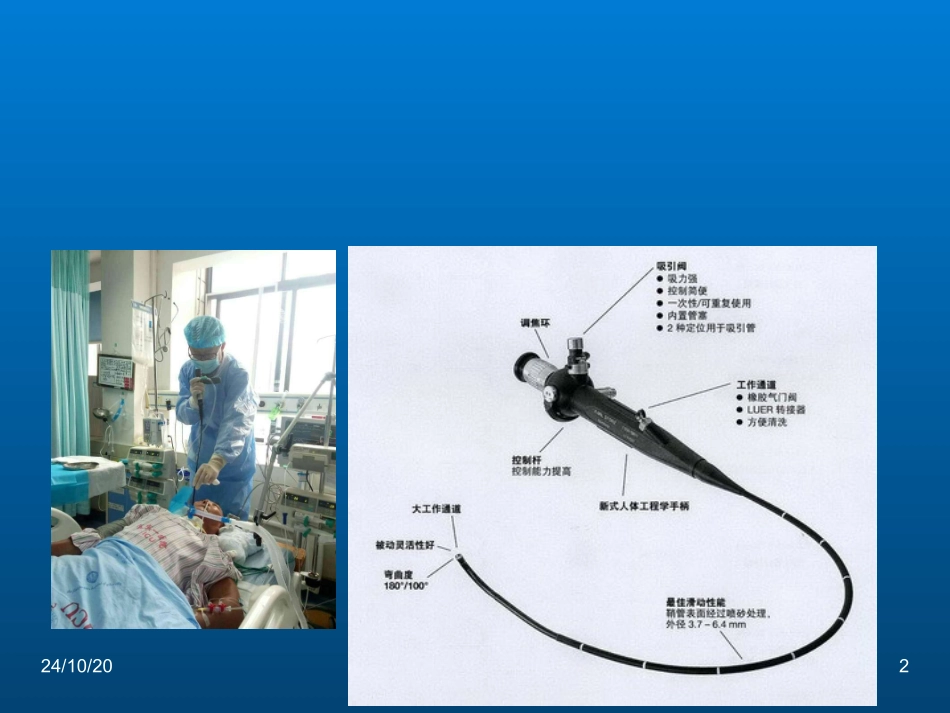 纤维支气管镜的临床应用_第2页