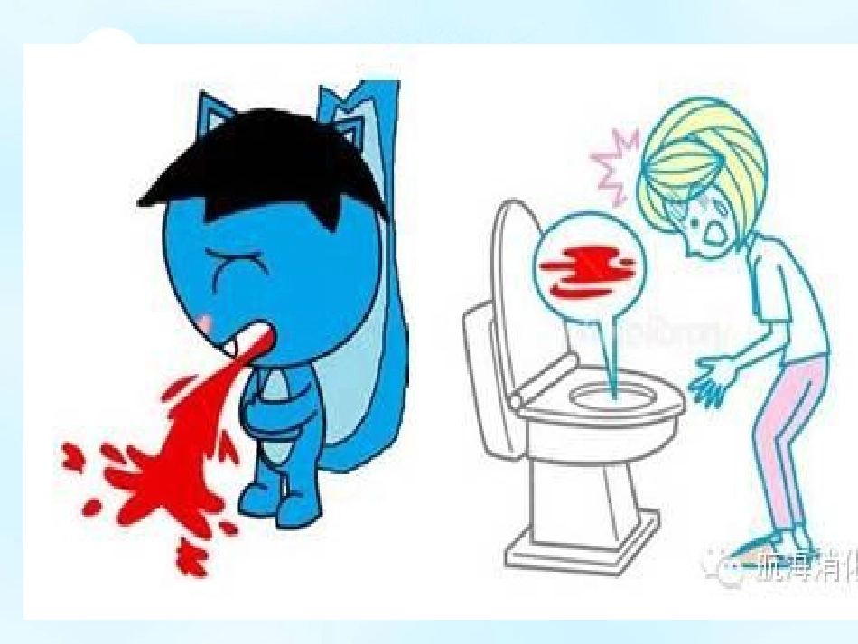 消化道出血护理课件_第2页