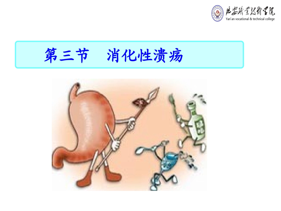 消化性溃疡病人的护理课件_第1页