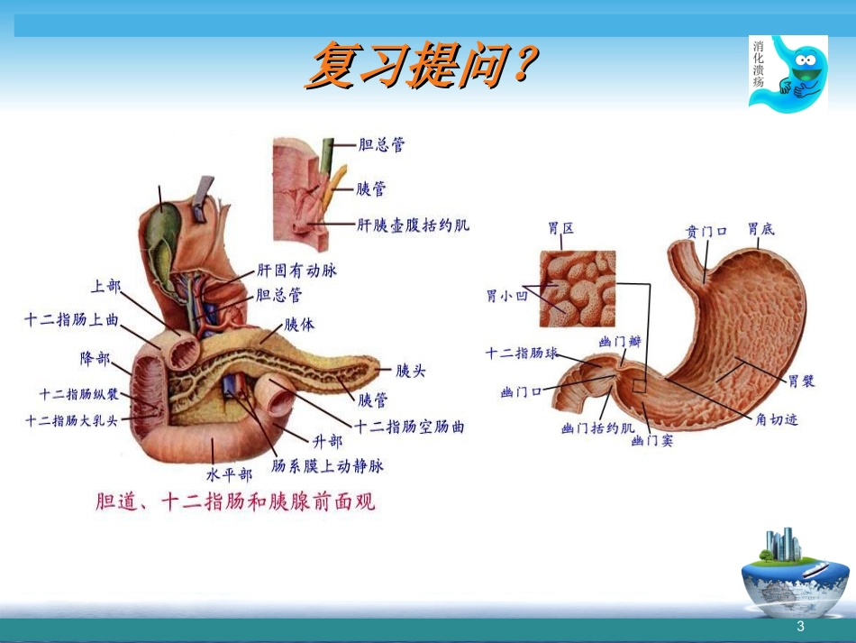 消化性溃疡病人的护理评估课件_第3页