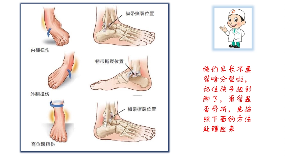 小儿运动损伤课件_第3页