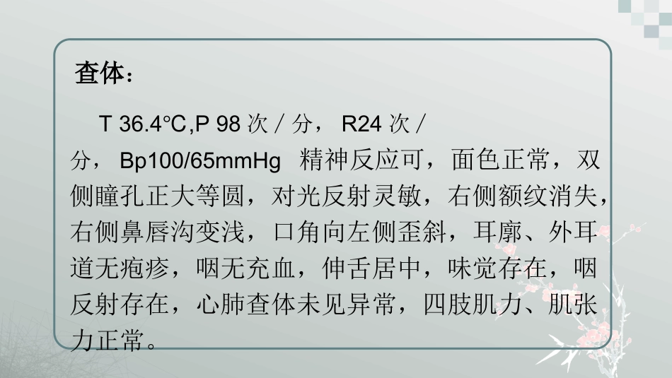 小儿周围性面神经麻痹_第2页