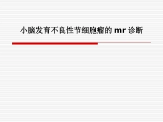 小脑发育不良性节细胞瘤的mr诊断