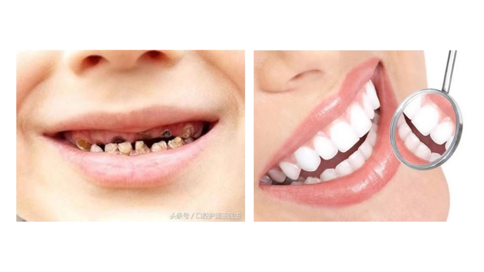 小熊不刷牙保护牙齿课件_第2页