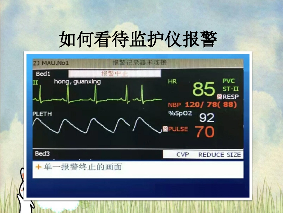 心电监护常见报警原因_第3页