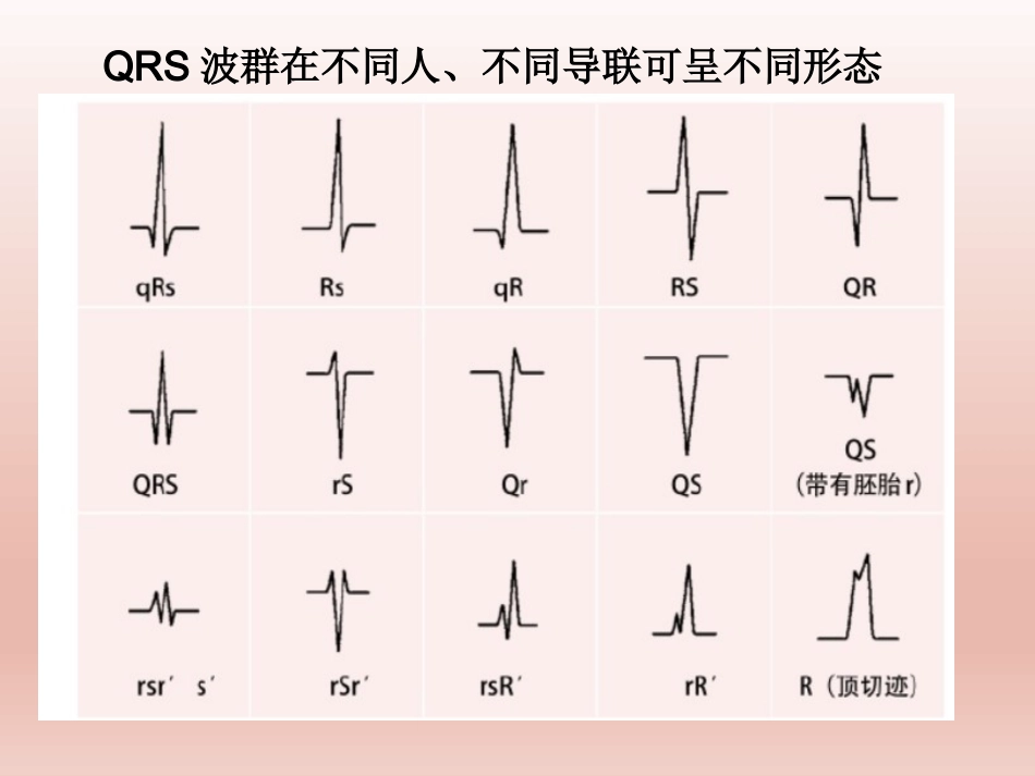 心电图基础知识讲解_第2页