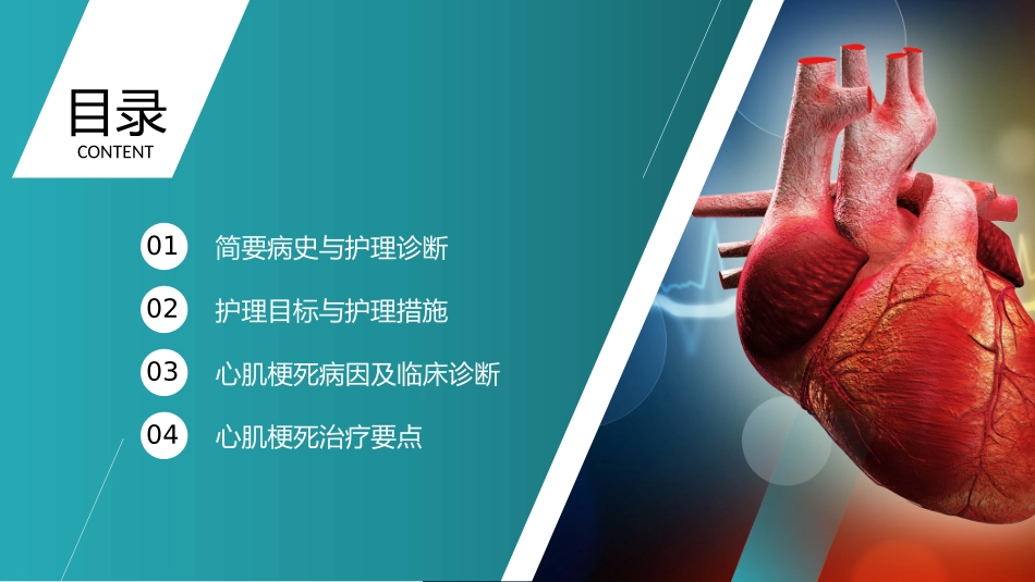 心梗心脏病护理查房病例讨论_第2页