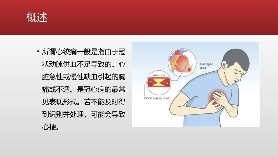心绞痛的急救措施_第2页
