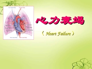 心力衰竭护理查房课件