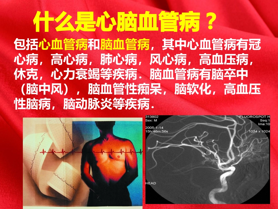 心脑血管病的危害_第2页