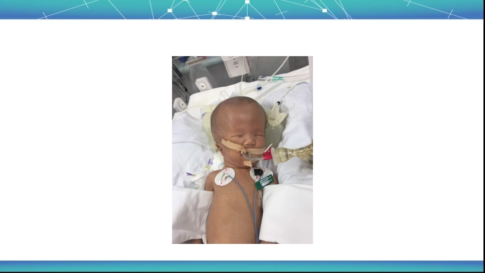 新生儿脑积水疾病查房_第2页