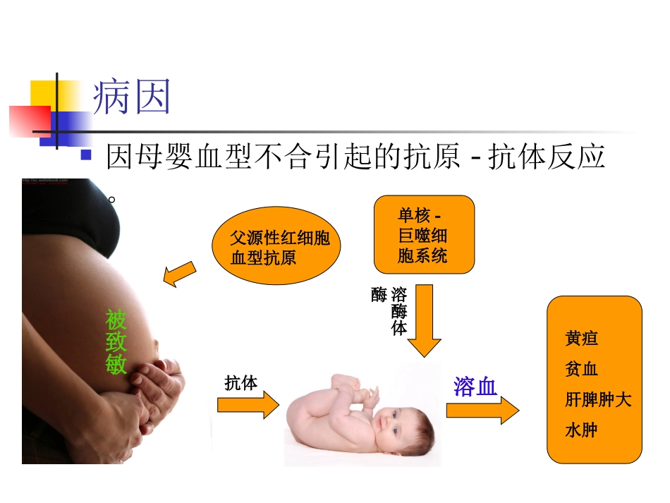 新生儿溶血病讲义_第3页