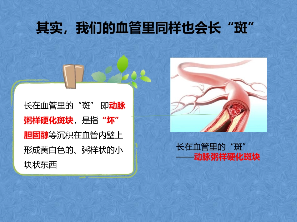 血管斑块的风险_第3页
