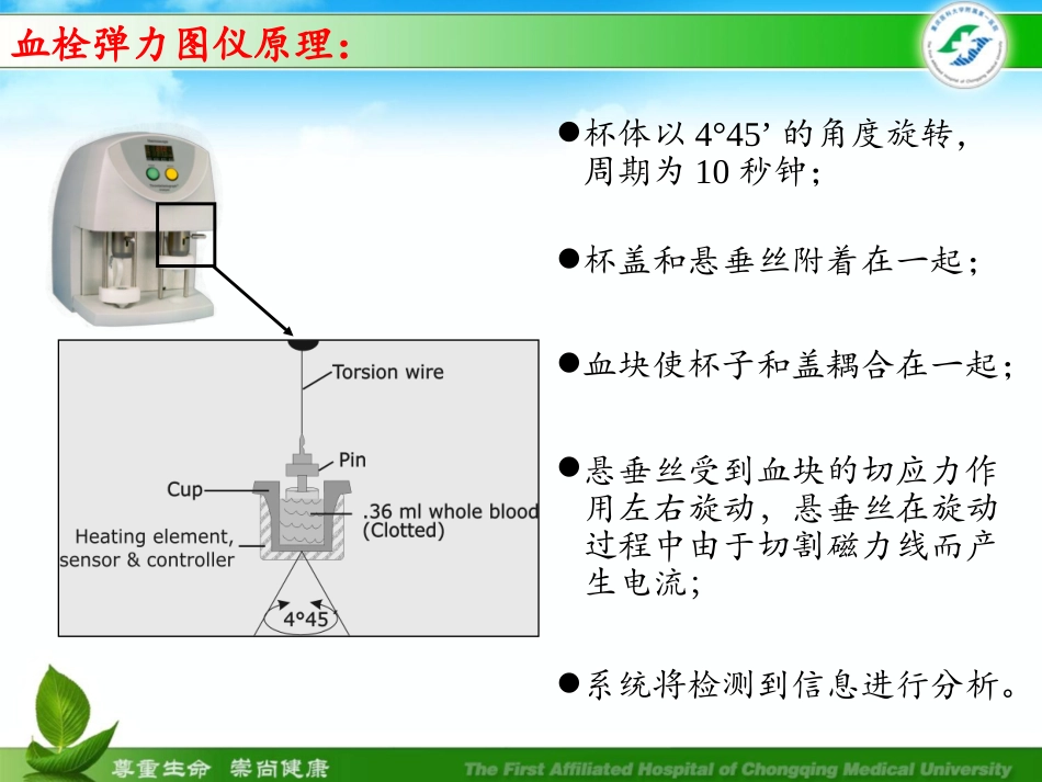 血栓弹力图解析及临床应用重症ICU_第3页