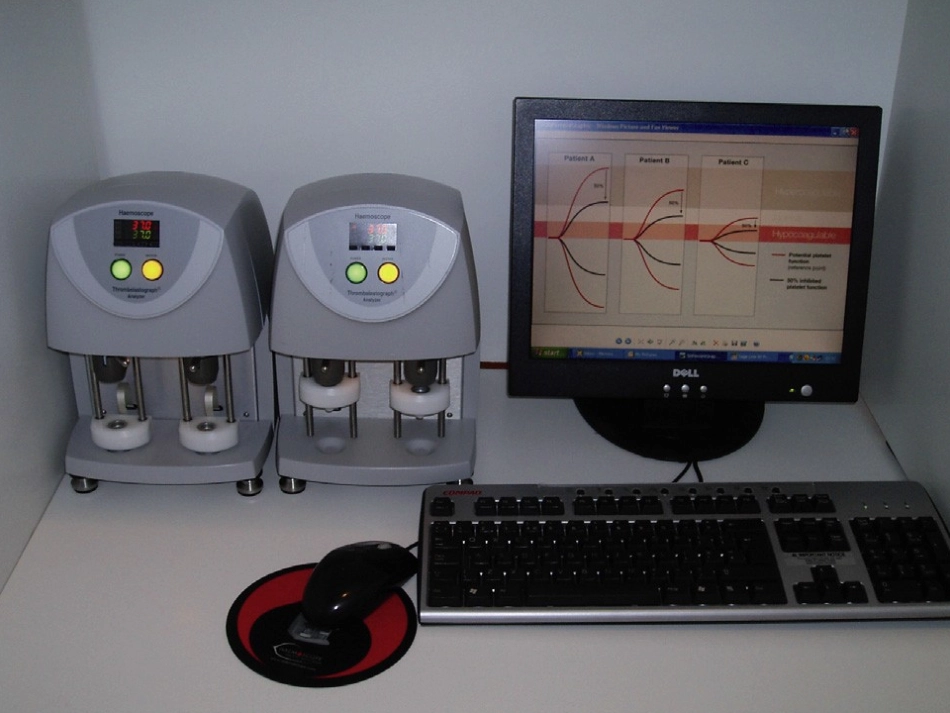 血栓弹力图临床用血介绍高长杰_第2页