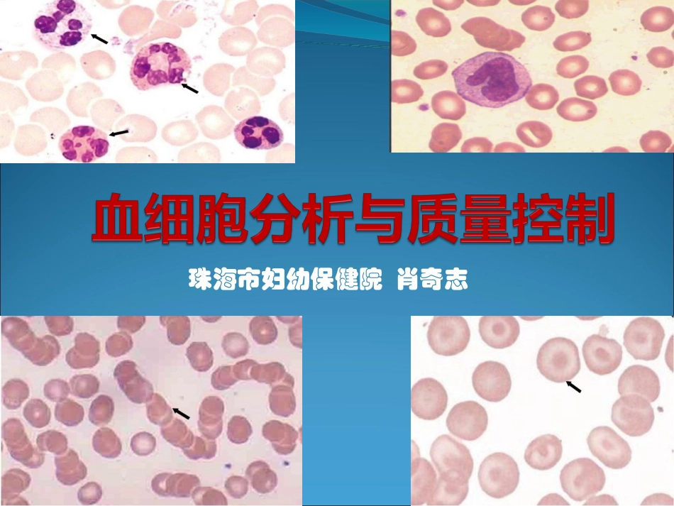 血细胞分析的质量控制_第2页