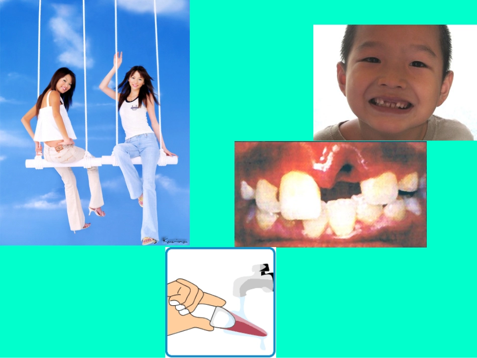 牙齿外伤的治疗_第2页