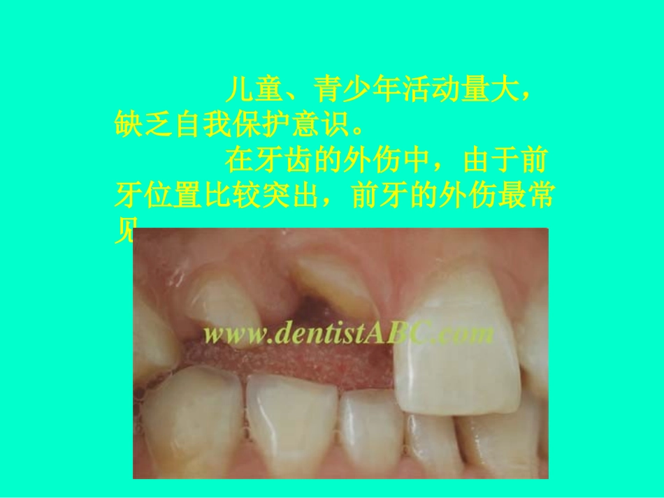 牙齿外伤的治疗_第3页