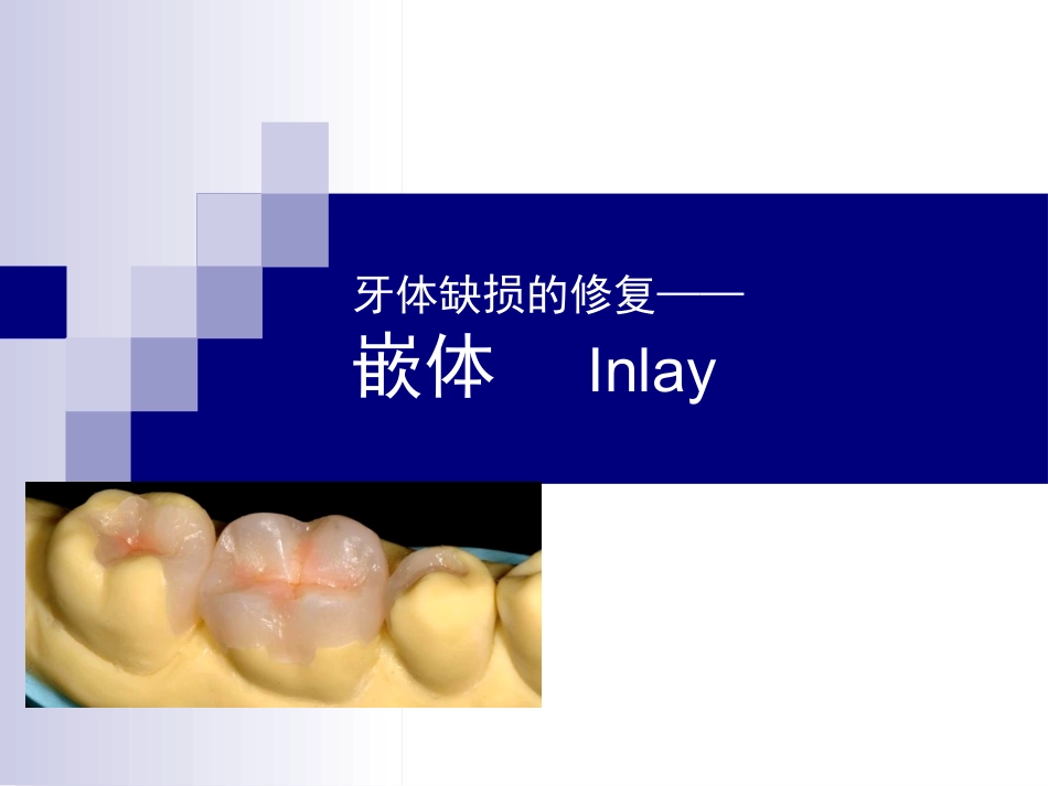 牙体缺损的修复嵌体_第1页