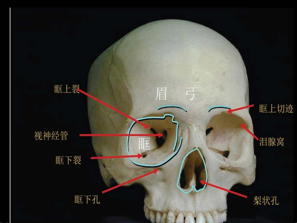 眼和眼眶的影像学诊疗_第2页