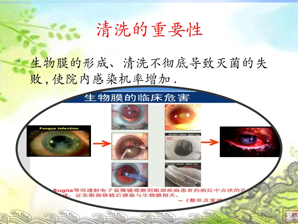眼科显微器械的清洗流程_第3页