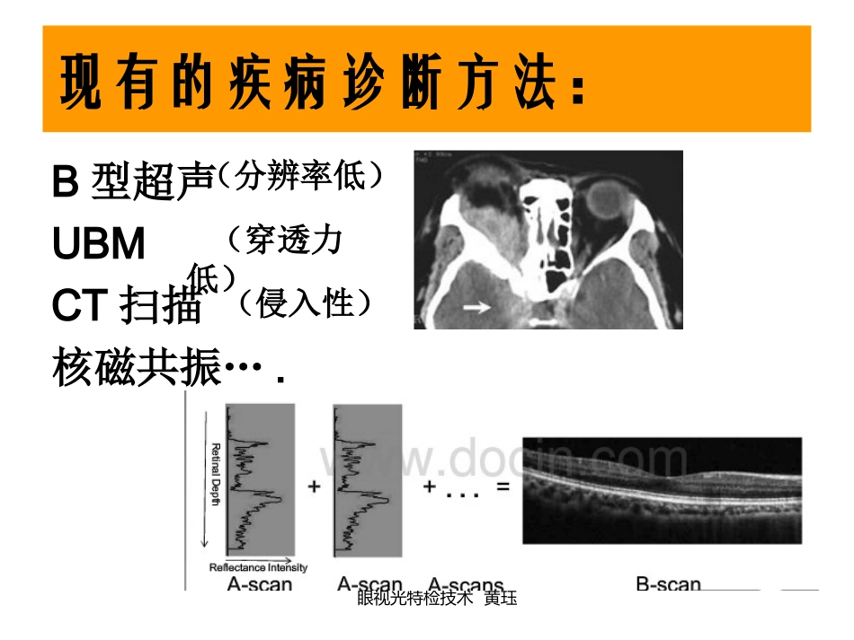 眼视光特检技术OCT教程文件_第2页