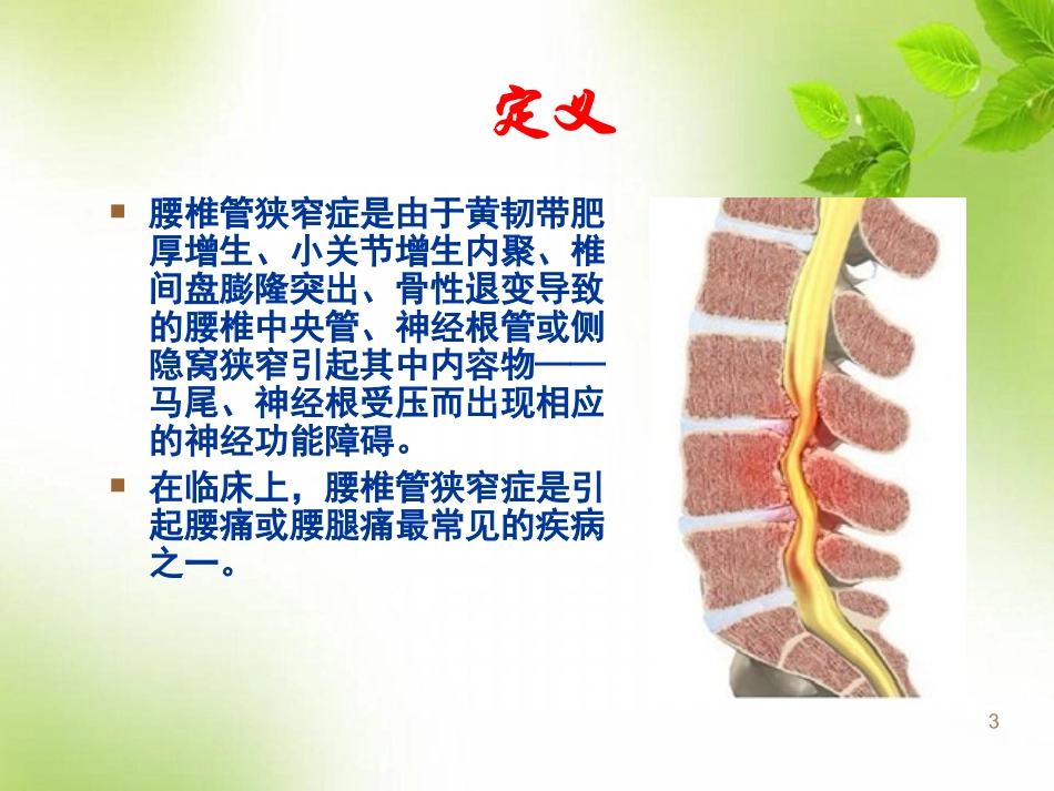 腰椎管狭窄医学课件_第3页