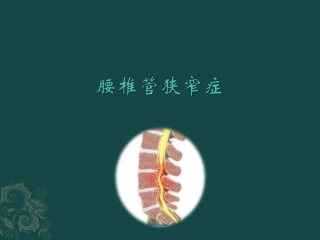 腰椎管狭窄症名医讲座