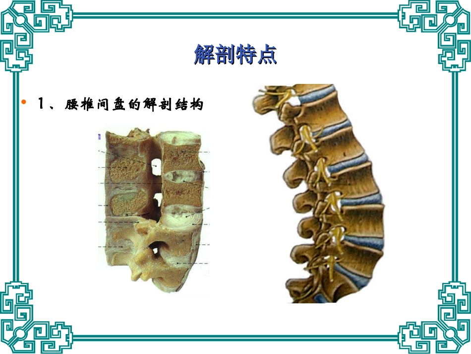 腰椎间盘突出症中医精品课件_第2页