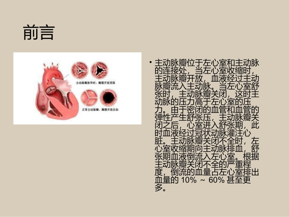 一例主动脉瓣置换术患者护理_第3页