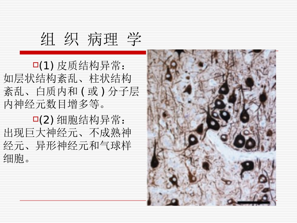 医学局灶性脑皮质发育不良专题课件_第3页