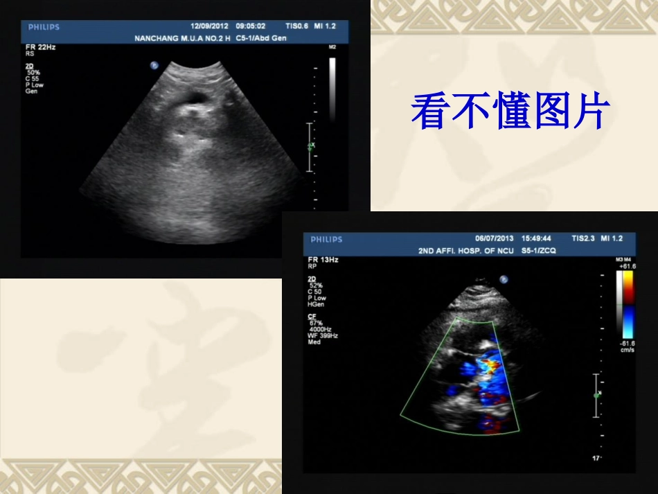 医学课件超声报告图像质量PDCA分析和评价_第3页