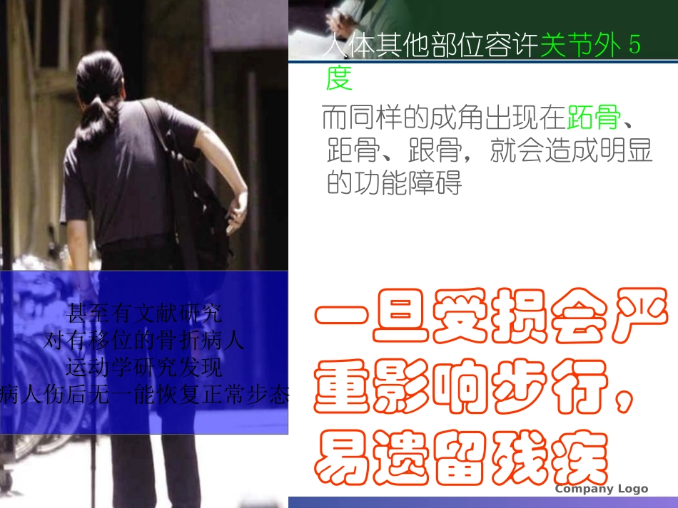 医学课件浅析Lisfranc损伤_第2页