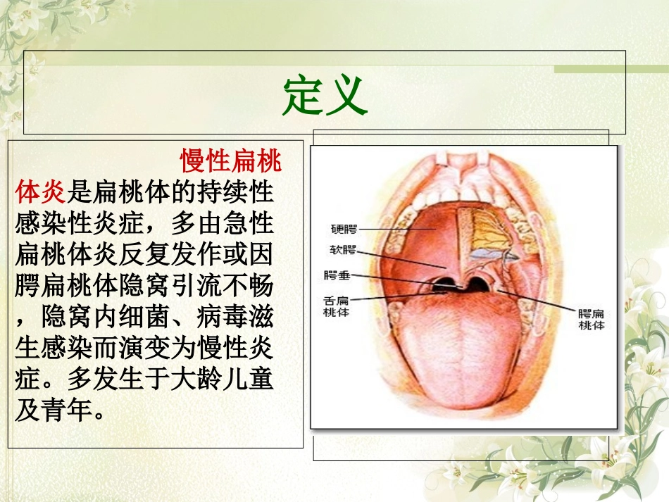 医学慢性扁桃体炎课件_第2页