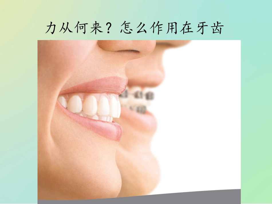 医学隐形矫治的附件课件_第3页